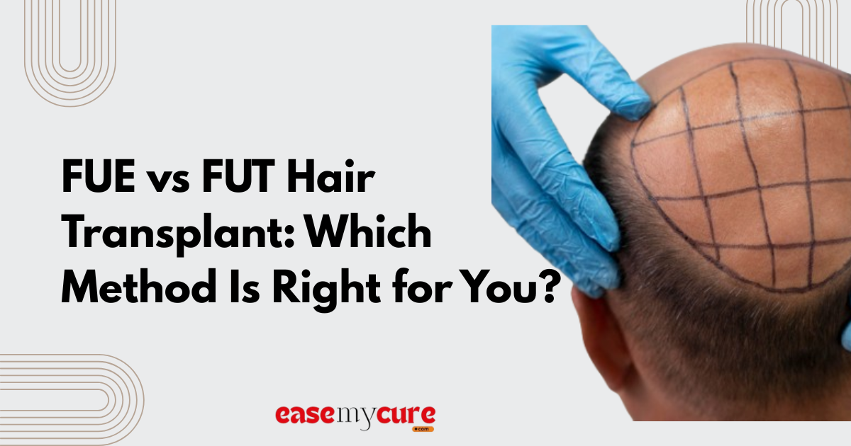 FUE vs FUT Hair Transplant: Which Method Is Right for You?