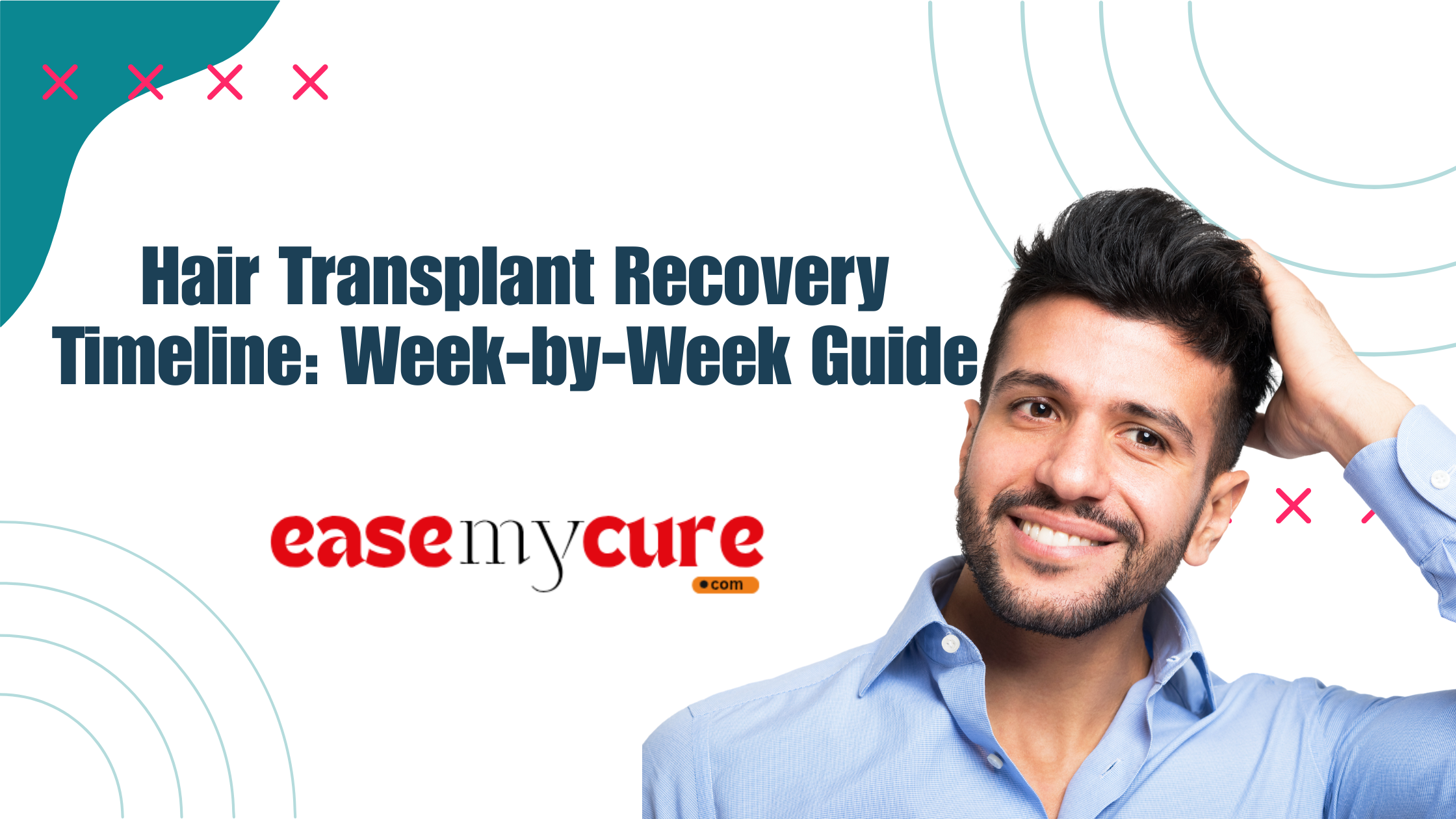 Hair Transplant Recovery Timeline: Week-by-Week Guide
