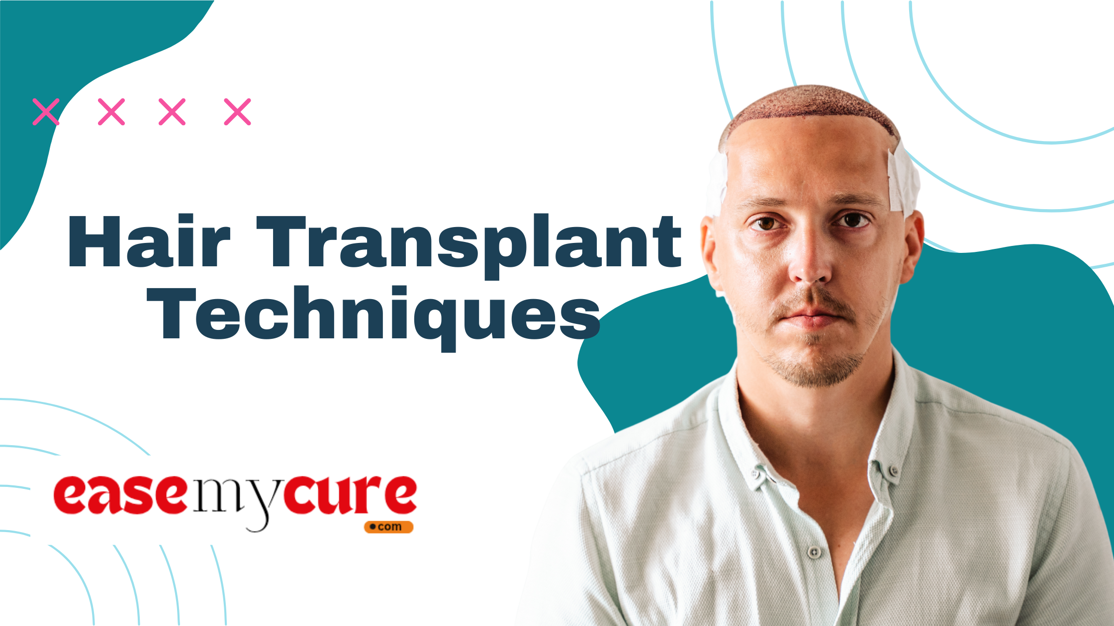 Hair Transplant Techniques