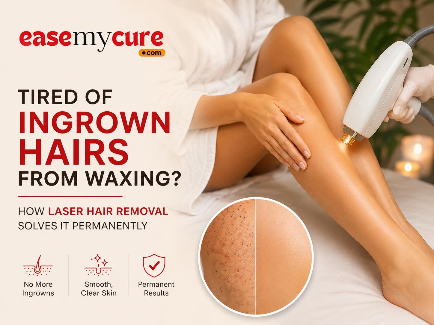 Ingrown Hair from Waxing: How Laser Hair Removal Solves It Permanently