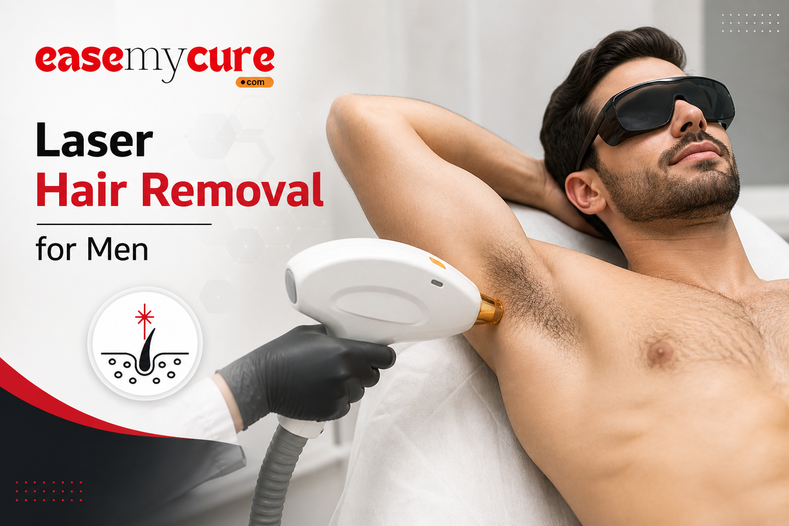 Laser Hair Removal for Men: Full Body Guide & What to Expect