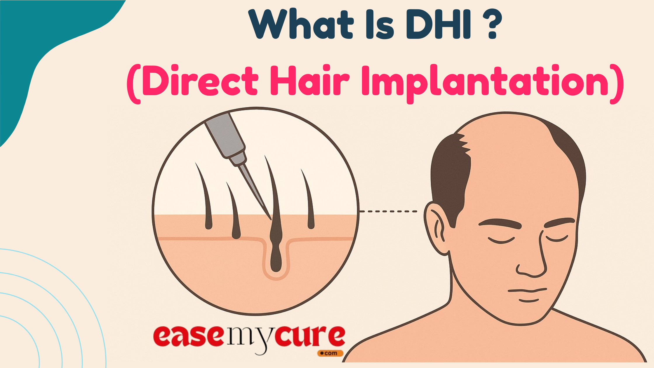 Video call of a fertility nutrition consultation with a kit 