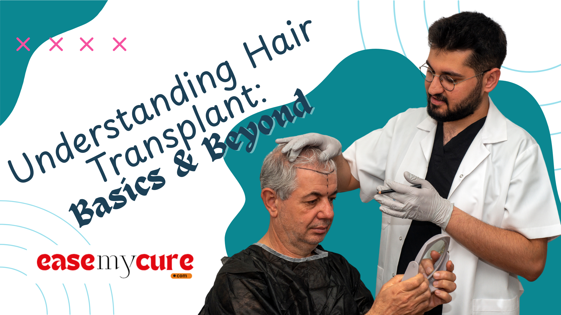 Understanding Hair Transplant: Basics & Beyond
