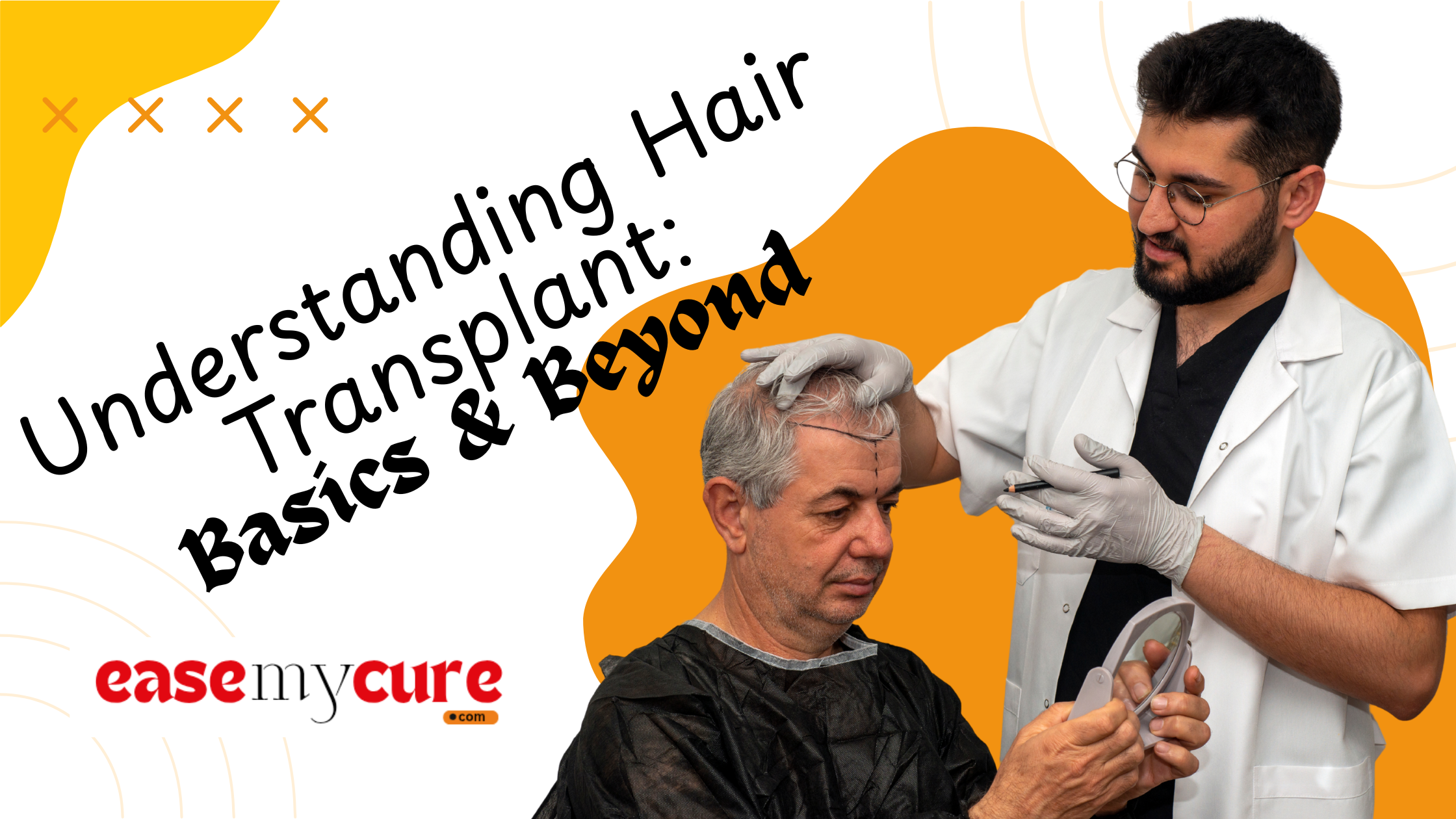 Understanding Hair Transplant: Basics & Beyond