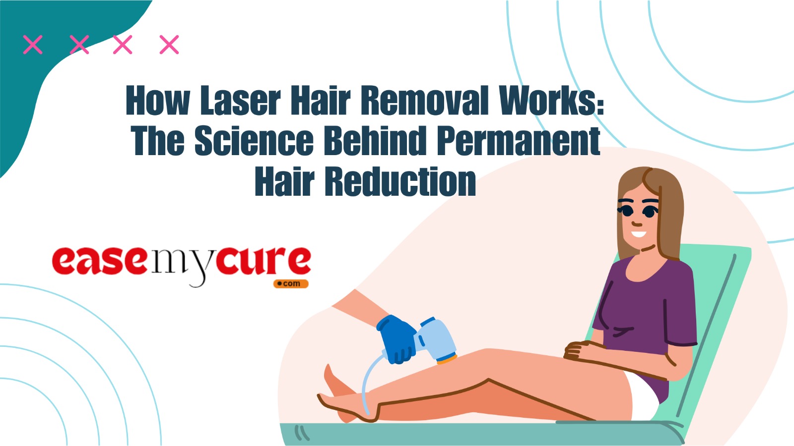 How Laser Hair Removal Works: The Science Behind Permanent Hair Reduction